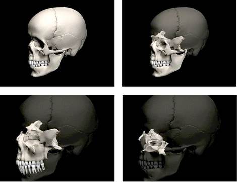 09-a-schede-ico-omnia-medicina-cranio-sequenza